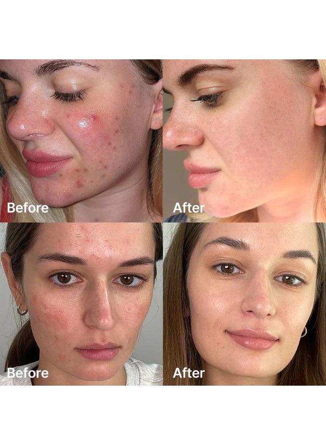 Medicube Red Succinic Acid Clarifying serum - Image 4